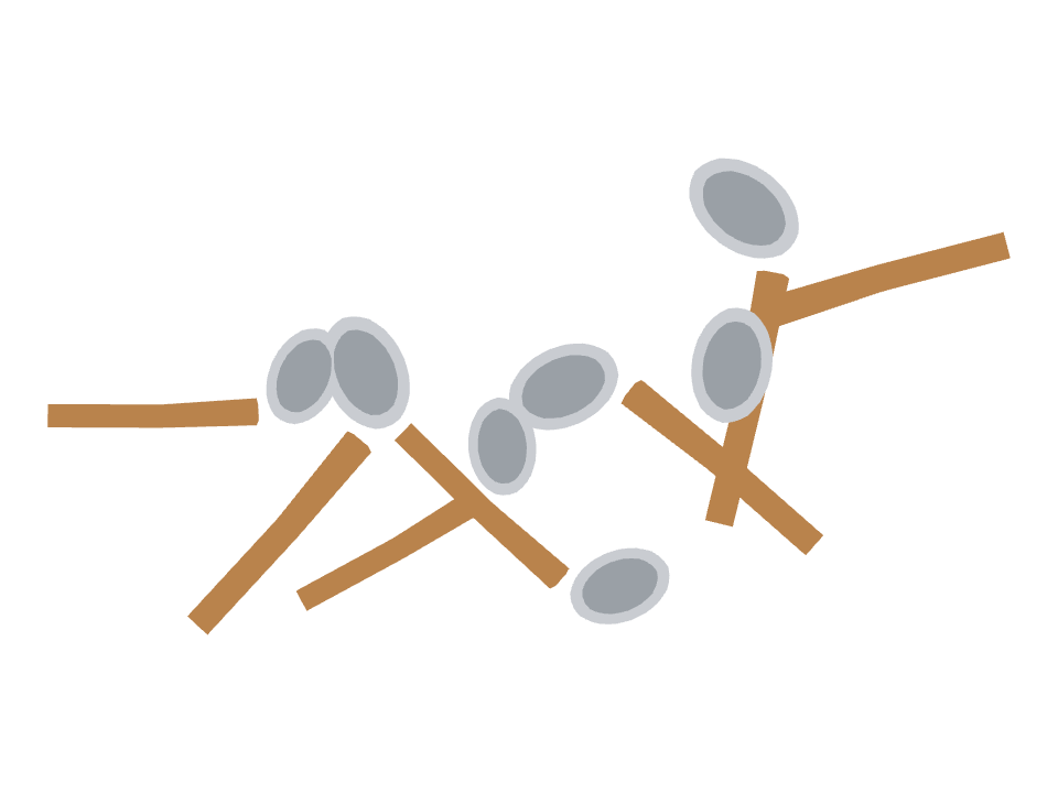 Ladle drawn along a curved stroke